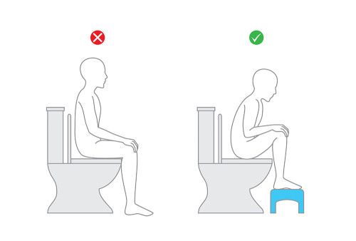 Illustration showing the correct way to sit on a toilet with feet raised on a footstool and body leaning forward. 